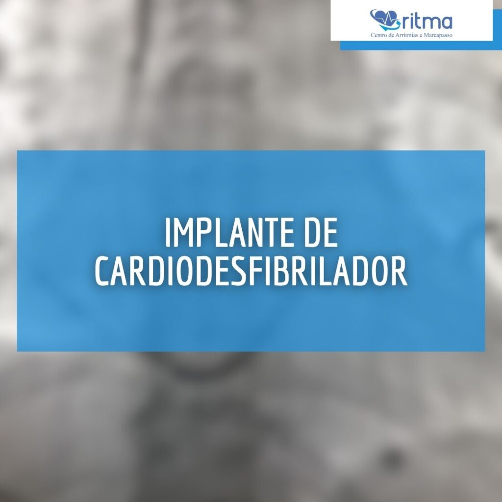 implante de cardiodesfibrilador 01