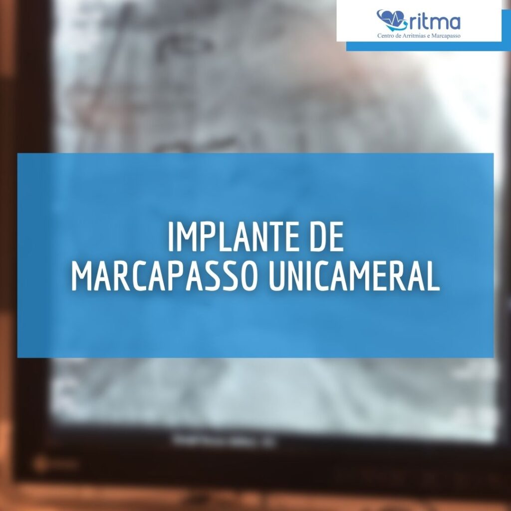 implante de marcapasso unicameral 01
