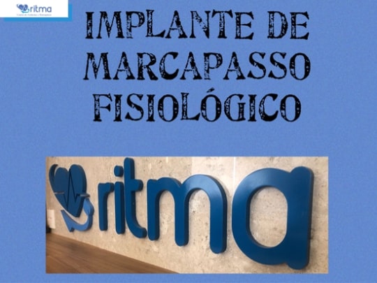 implantes-de-marcapasso-fisiologico-1